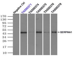 IHC-plus™ SERPINA1 / Alpha 1 Antitrypsin Antibody (clone 5B12)