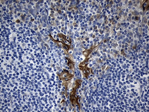 MOK / RAGE Antibody (aa205-419, clone OTI6C12)