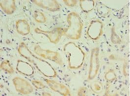 MATN3 / Matrilin 3 Antibody (aa277-486)