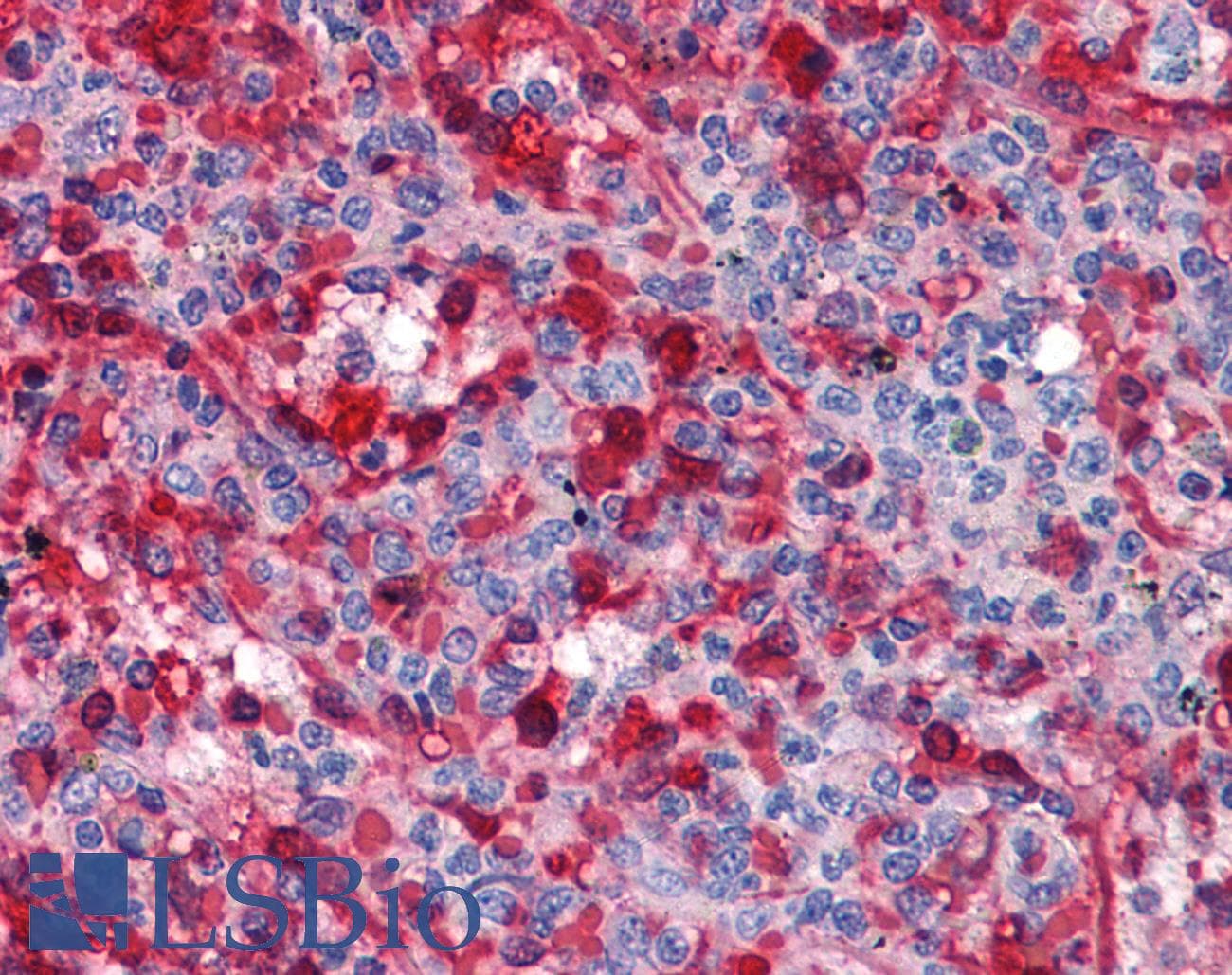 IHC-plus™ WDR20 Antibody (clone 2A6)