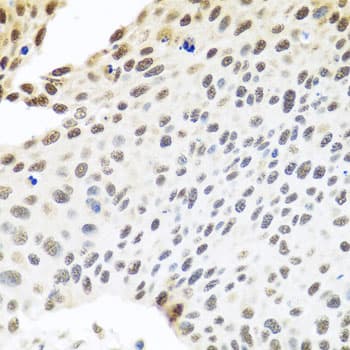 IHC-plus™ Polyclonal Rabbit anti-Human SKIV2L2 Antibody (IHC, WB)