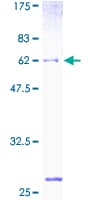 Human GALE / UDP-Glucose 4-Epimerase Protein (Recombinant GST)