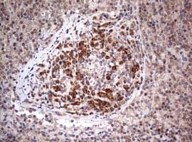 Monoclonal Mouse anti-Human PIK3CA / PI3K Alpha Antibody (clone OTI8D6, aa303-631, IHC)