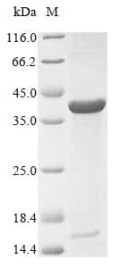 Neisseria meningitidis porB Protein (Recombinant 6His, N-terminus)