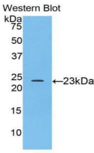 SPTAN1 / Alpha Fodrin Antibody (aa595-783, Cy3)