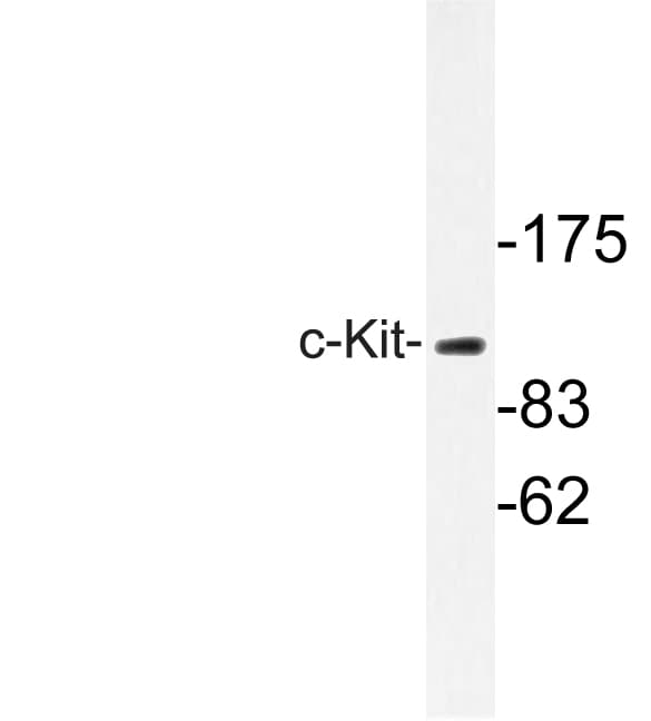 c-Kit / CD117 Antibody (Ser715)