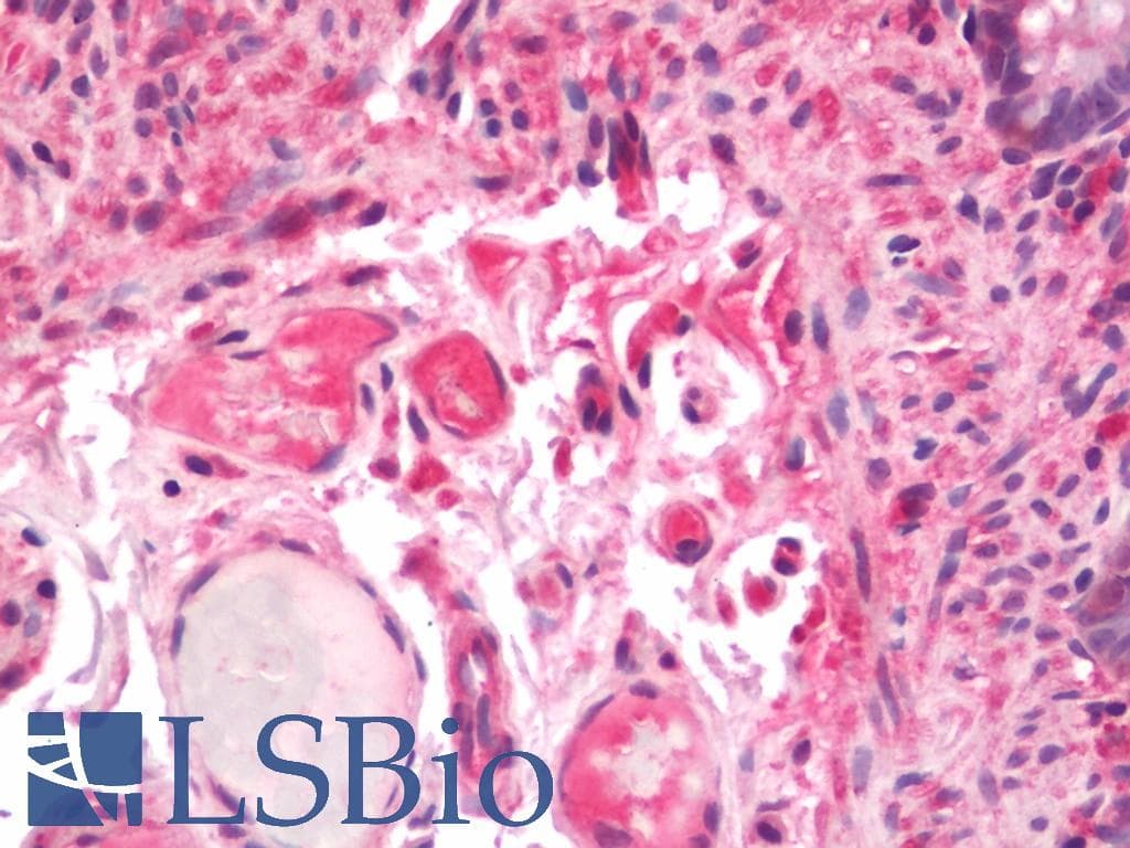 IHC-plus™ PRPSAP1 Antibody (aa1-356)