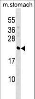 CRYBA4 Antibody (aa98-127)