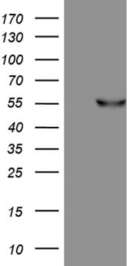 FCRLB / FREB-2 Antibody (aa202-426, clone OTI1E1)
