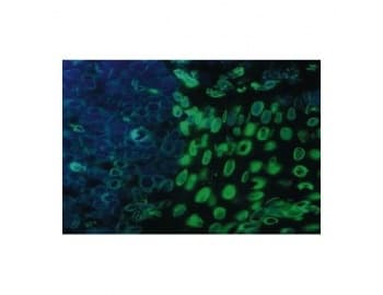 LMNA / Lamin A+C Antibody (aa572-646, clone JOL4)