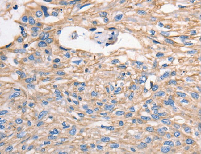 MVP / VAULT1 Antibody