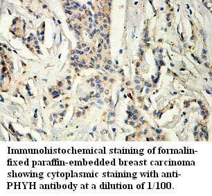 RD / PHYH Antibody (aa34-321)
