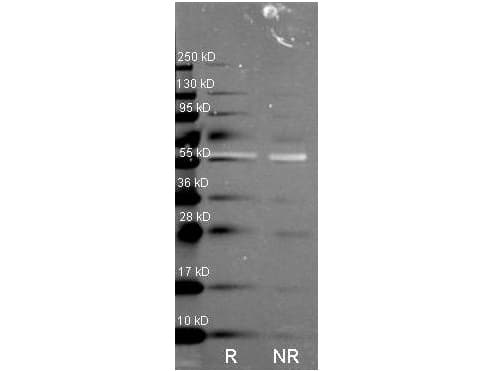 CAT / Catalase Antibody (Lyophilized, HRP)