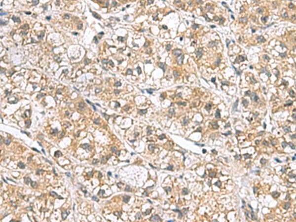 PPIH / Cyclophilin H Antibody