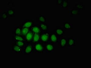 ZBTB33 / Kaiso Antibody
