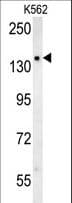 SLC12A5 / KCC2 Antibody (aa5-33)
