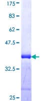 Human IRX5 Protein (Recombinant GST, N-terminus)