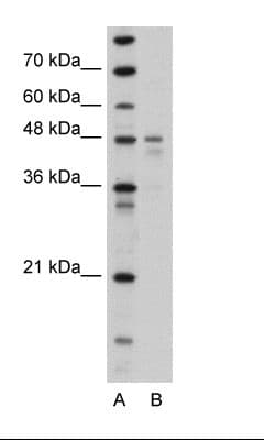 PDK4 Antibody (N-Terminus)