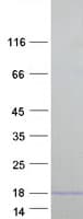 Human GNLY / Granulysin Protein (Recombinant Myc-DDK (Flag))