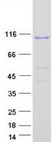 Human BCAS3 Protein (Recombinant Myc-DDK (Flag))