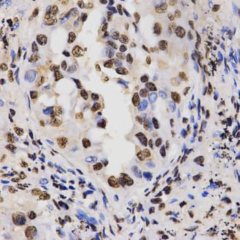 Histone H3 Antibody (Asym-Di-Methyl-Arg17)