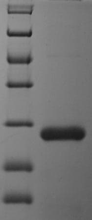 Bordetella pertussis fim3 Protein (Recombinant 6His, N-terminus)