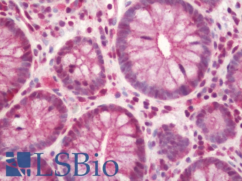 IHC-plus™ SLX4 Antibody (aa1784-1834)