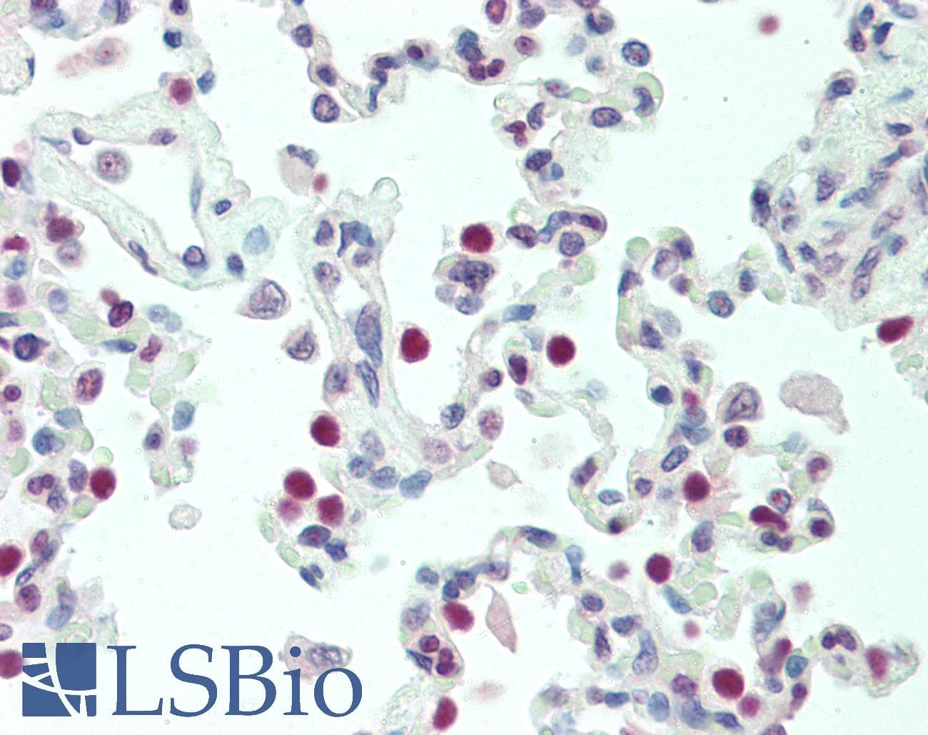 PathPlus™ NKX2-1 / Thyroid-Specific TF Antibody (aa1-30)