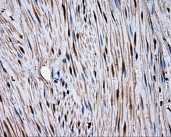 Monoclonal Mouse anti-Human MCL1 / MCL 1 Antibody (clone OTI4B7, IHC, IF, WB)
