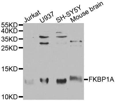 IHC-plus™ Polyclonal Rabbit anti-Human FKBP1A / FKBP12 Antibody (IHC, WB)