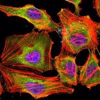 KDM3A / JMJD1A Antibody (clone 20)