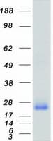 Human RHOA Protein (Recombinant Myc-DDK (Flag))