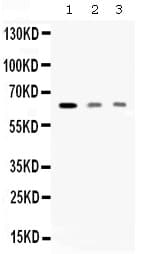 Polyclonal Rabbit anti-Human AMHR2 / MISRII Antibody (WB)