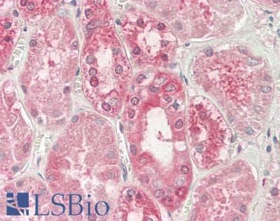 IHC-plus™ Myosin VI / MYO6 Antibody (N-Terminus)