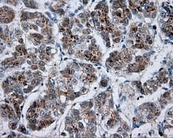 BTK Antibody (clone OTI1H7)
