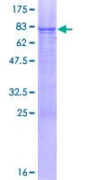 Human GGT6 Protein (Recombinant GST)
