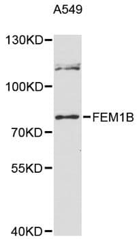 FEM1B Antibody