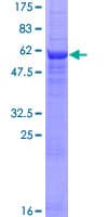 Human CNTD1 Protein (Recombinant GST)