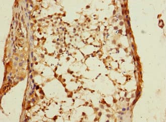 DSTYK / RIPK5 Antibody