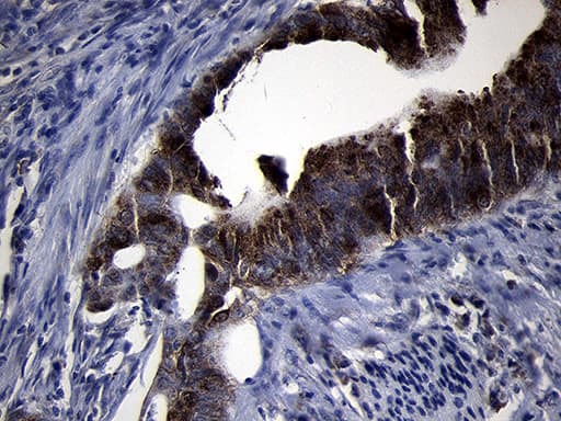 Monoclonal Mouse anti-Human RRM2 Antibody (clone OTI1F2, IHC, WB)