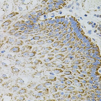 EPO / Erythropoietin Antibody