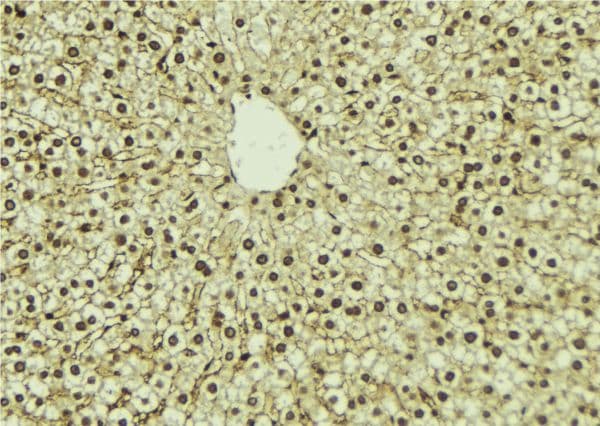 Polyclonal Rabbit anti-Human PIP5K1A Antibody (IHC, WB)