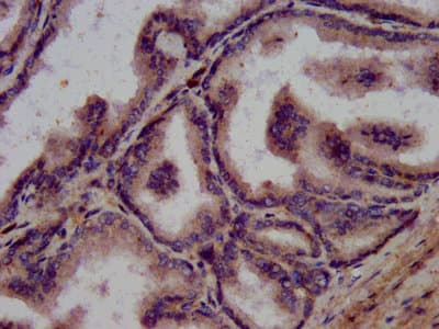 WFDC2 / HE4 Antibody