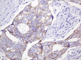 CTNND1 / p120 Catenin Antibody (clone OTI2E8)