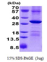 Human POP4 Protein (Recombinant His)