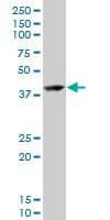 RNF2 / RING2 / RING1B Antibody (clone 3G6)