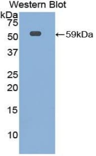 IL10RA Antibody (aa17-241)