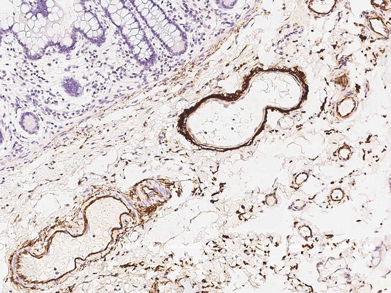 APCS / Serum Amyloid P / SAP Antibody (Preservative Free)
