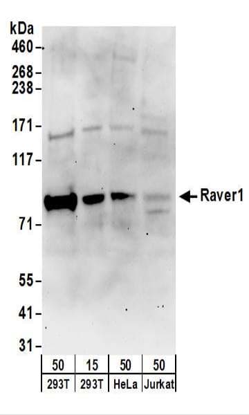 RAVER1 Antibody (aa556-606)