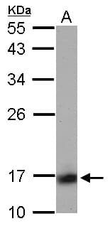 PPP3R1 / Calcineurin B Antibody